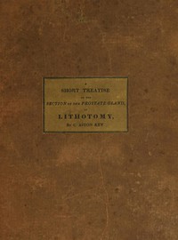 A Short Treatise on the Section of the Prostate Gland in Lithotomy  With an Explanation of a Safe and Easy Method of Conducting the Operation on the Principles of Cheselden